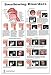 Swallow Disorders Anatomy Poster 24x36inch, Dysphagia Endoscopic View-oral Phase Disorders-nasal Regurgitation