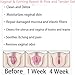 Bee Toxin Ginger Oil, Bee Toxin Ginger Oil Capsules, Bee Venom Ginger Oil Capsules,Bee Venom Natural Repair Tighten Vaginal Capsules (3Pcs)