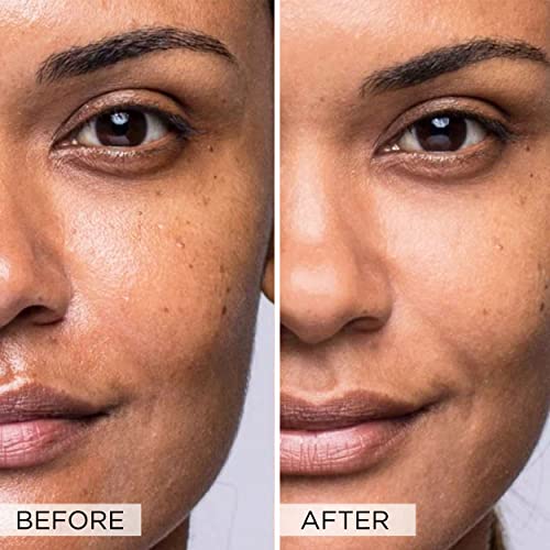 Dr. Brandt Cleanser. Pores No More Pore Purifying Cleanser. Non-Drying, Pore-Refining Cleaner With Salicylic Acid And Tea Tree Oil. Dissolves Impurities, Eliminates Excess Oil And Residue, 3.5 Fl Oz. #TOP5