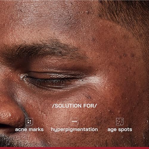 Image of /PHD / 2% Alpha Arbutin Depigmentation Serum | Alpha Arbutin for Pigmentation & Dark Spot | Pigmentation serum for Women & Men | Tyrobright, Niacinamide | Tan removal | Fragrance-Free | 10ml
