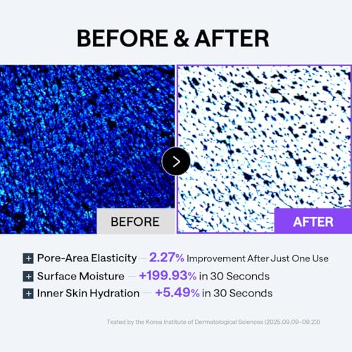 Image of MEDIHEAL Derma 365 Daily Mask [PDRN] 30 Sheets - Hyaluronic Acid for Deep Moisturization & Squalane for Restoring Skin Barrier, Korean Face Mask for Pore Care & Glow Skin