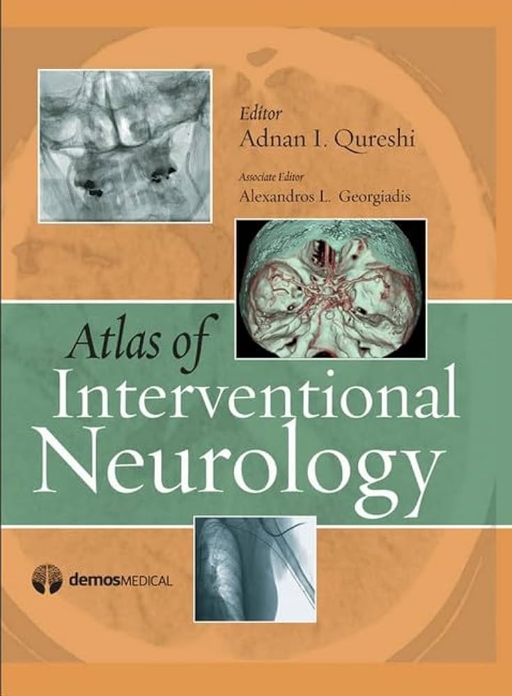 Atlas of Interventional Neurology: 9781933864310: Medicine