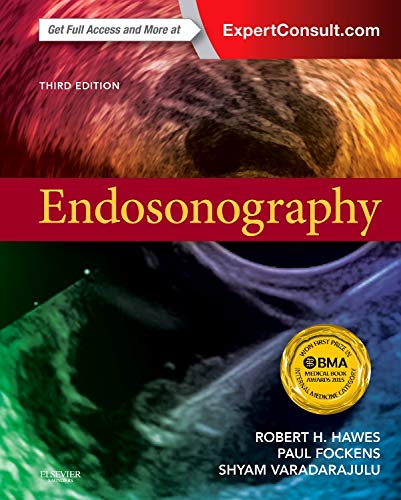 Endosonography, 3e (Else01) Endosonography, 3e (Else01)