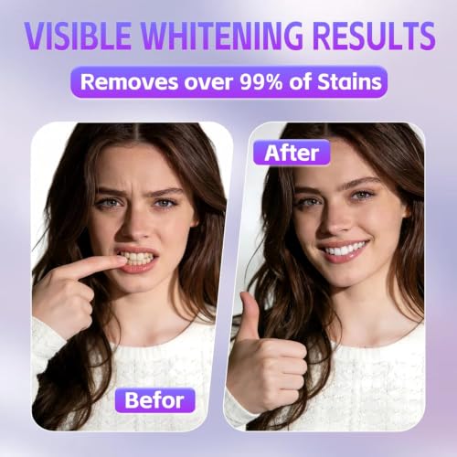Image of Teeth Whitening Powder - Upgraded Pap + Hydroxyapatite Tooth Powder for Sensitive, Natural Teeth Whitening for Enamel Safe, Remineralizing Tooth Powder Toothpaste for Deep Clean Coffee Stain Removal