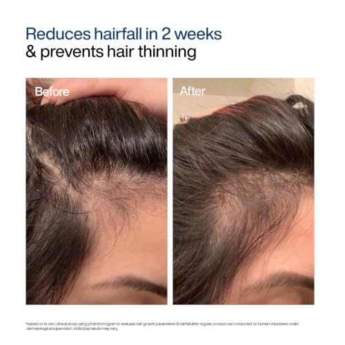 Image of WishCare Hair Growth Serum For Scalp, In-Vivo Tested, For Women & Men, 60ml | 100% Saw Hairfall Reduction, 94% Saw New Hair Growth, Advanced Hair Growth Serum With Redensyl & Rosemary Oil