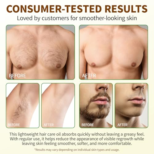 Image of Uocasi Cyperus Rotundus Oil, Cypress Rotundus Oil for Hair Removal, Natural Inhibitor to Reduce Unwanted Hair Growth, Soothes Skin & Minimizes Pores, All Skin Types, 2.02 Oz