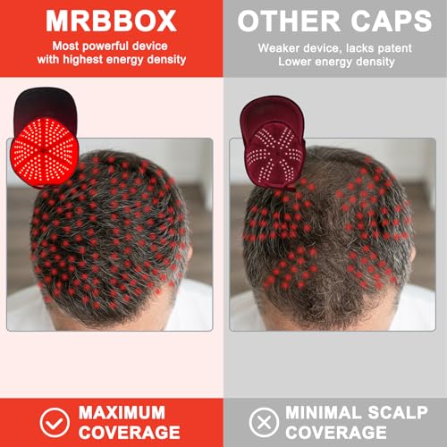 Image of Red Light Hair Growth Cap - FDA Cleared Red Light Therapy for Hair Growth for Men & Women
