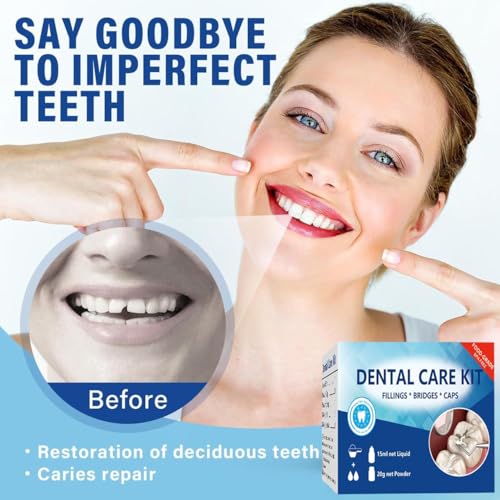 Image of Temporary Replacement Tooth Repair Kit, Zinc Oxide Eugenol Cement Dental Care Kit Glue for Crowns & Bridges Filling, Perfect Smile (4)