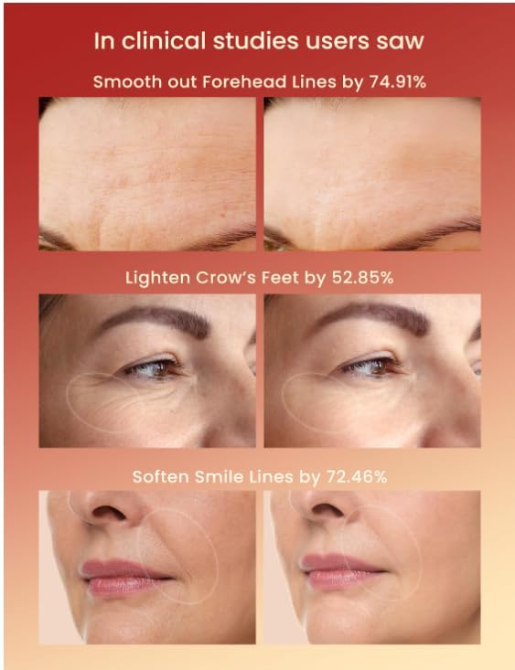 Red Light therapy Mask for Face Wrinkles,Silicone Portable Led Facial Mask Light Therapy for Full Face Even Skin Tone,Fine Lines&Wrinkles,10- Min Treatment,Wired - Image 2