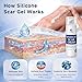 Rvlaim Silicone Scar Cream Scar Gel, Advanced Scar Removal Cream for Surgical Scars, Acne Marks, Stretch Marks, Keloids, C-Section, Burns, Old and New Scars, 1.7 fl oz