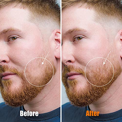 5% Minoxidil Beard Growth Kit Beard Derma Roller Beard Growth Oil For Men, Beard Roller Microneedle Roller 0.25Mm For Men Mustache Patchy Beard Growth #TOP5