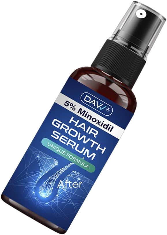 5% Minoxidil Spray for Women and Men Hair Growth