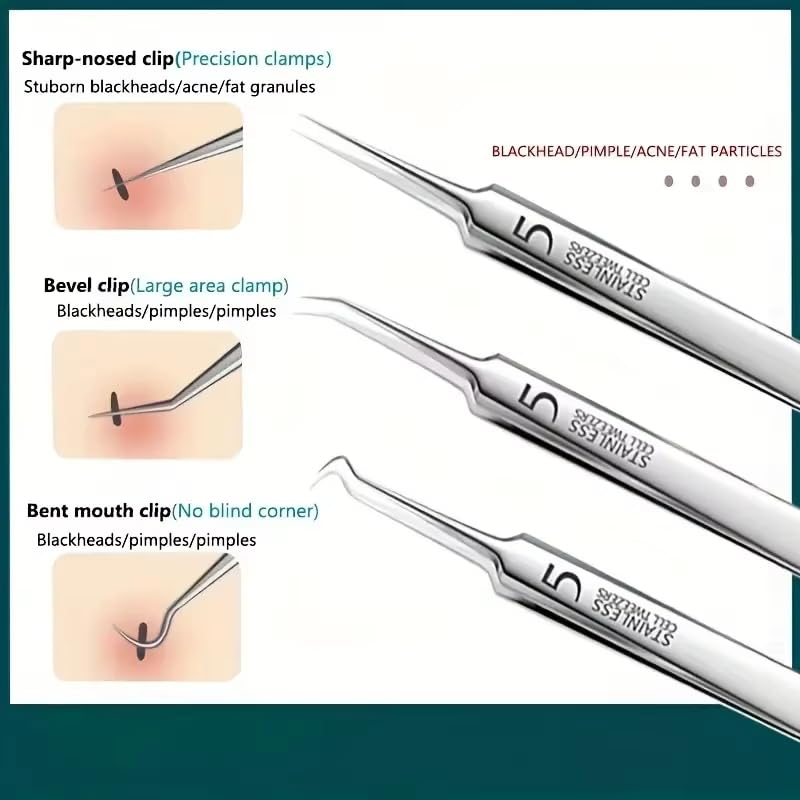 Stainless Steel Acne Clip, Cell Clip, Blackhead Clip, Acne Needle, Beauty Salon Acne Needle, Acne Needle Tool