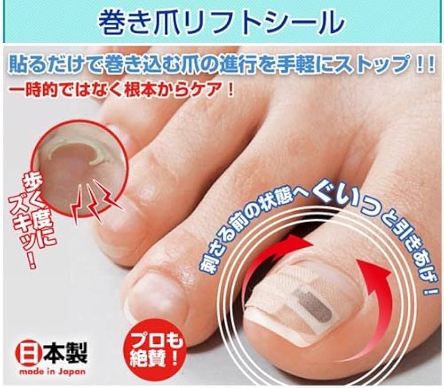 巻き爪リフト　9個セット【正規品】 巻き爪リフト 9個セット【正規品】