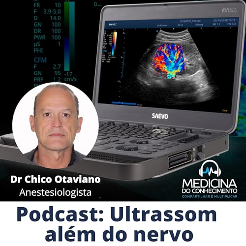 #163 Ultrassom Além Do Nervo