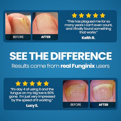 Funginix 100 Toenail Fungus Treatment thumb #3