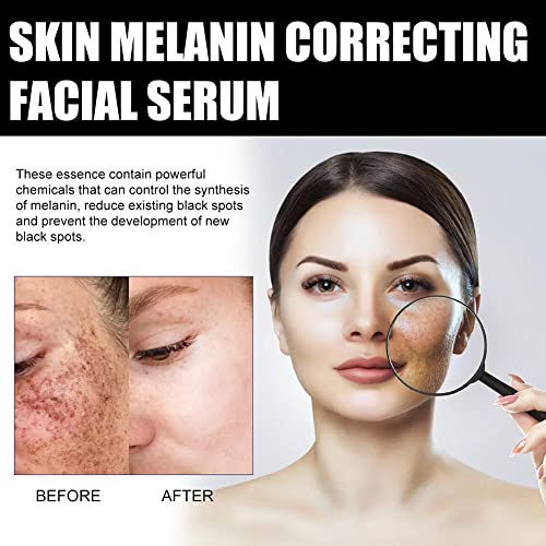 Melanin Correcting Facial Serum,Melanin Correcting Serum For Face, Dark Spot Corrector Daily Face Serum, Melanin Correcting Facial,Reduce Apperance Of Dark Spots #TOP7