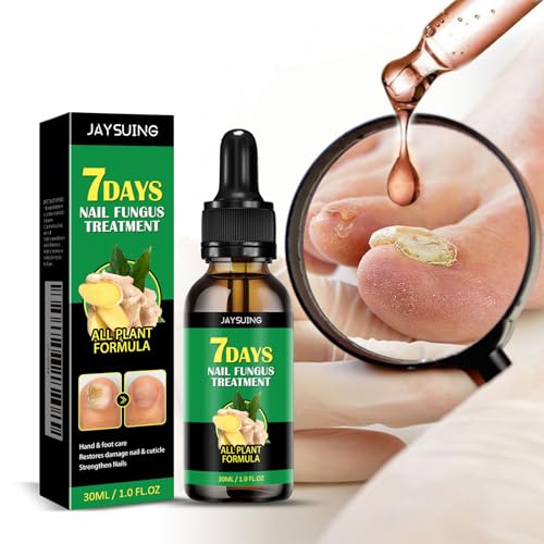 Toenail Fungus Treatment Extra Strength-7 days Nail Fungus Treatment,Ginger Nail Treatment,Toenail Cuticle Care Oil Care,Multi-Purpose Nail Repair for Your nails a Natural Shine-1 fl oz