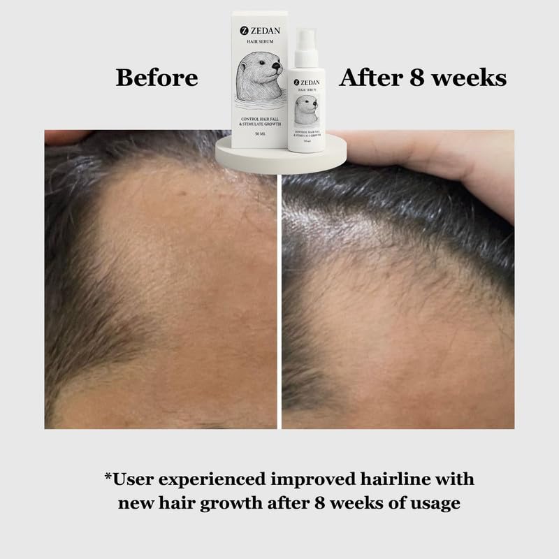 Image of ZEDAN Hair Growth Serum Spray (50 ML) | Control Hair Fall & Promotes Hair Growth | Redensyl, Anagain, Procapil, Baicapil | Strengthen Roots & Hydrate Scalp | All Hair Types | For Women & Men
