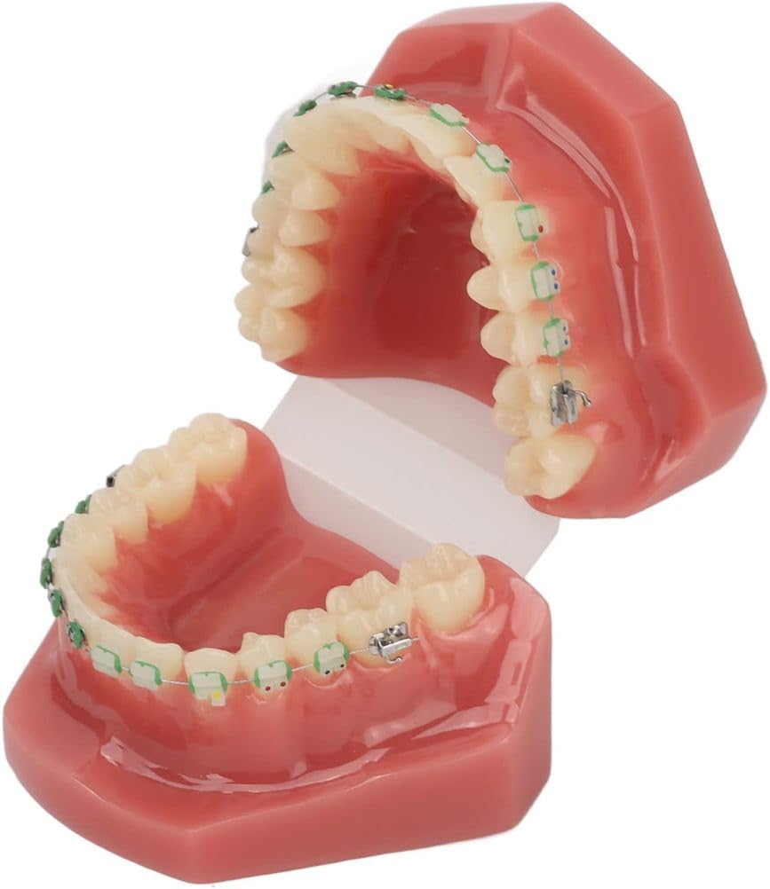 Modello di Ortodonzia Dentale,Modello di Ortodonzia Dentale in Resina,Modello di Ortodonzia Dentale Modello Dentale con Supporto di Fili Metallici per L'insegnamento