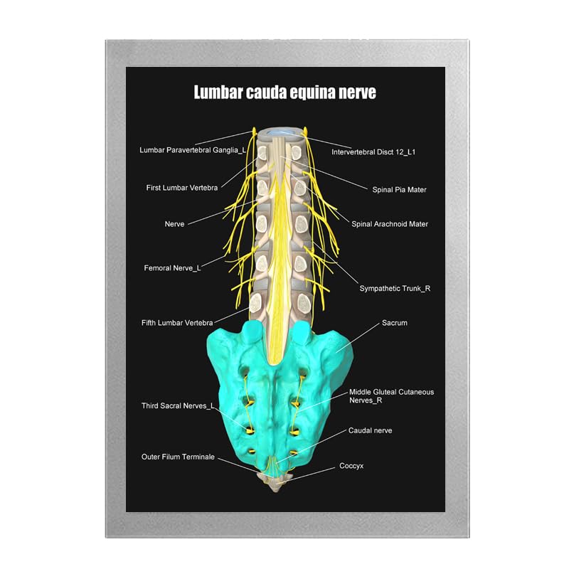 Image of Taanfu Body Educational Learning Anatomy Posters ，Equina Nerve Art Nerve Villi Anatomy Art Poster Digestive System Organs Illustration Small Intestine Physiology Anatomy Wall Art Villi