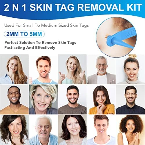 Skin Tag Remover Kit, 2 in 1 Skin Tag Remover Device for Medium/Small/Large Skin Tags (2mm-7mm), Painless Skin Tag & Mole Wart Removal Tool for Women Men