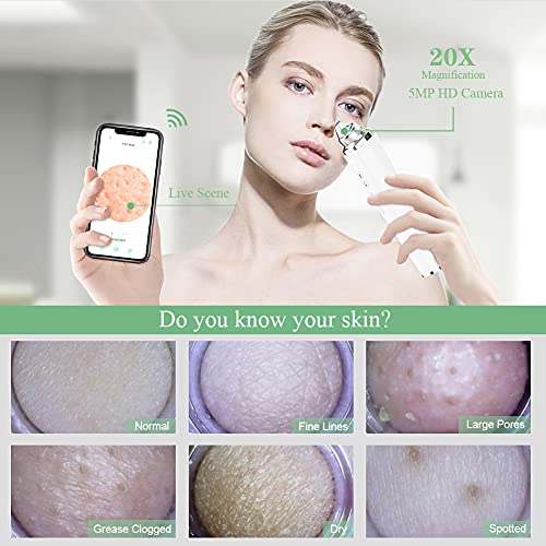 Mee-eters Remover Poriënvacuüm, Opgewaardeerd WIFI Zichtbare Porie Cleanser met HD Camera Puistje Acne Comedone… - Afbeelding 3
