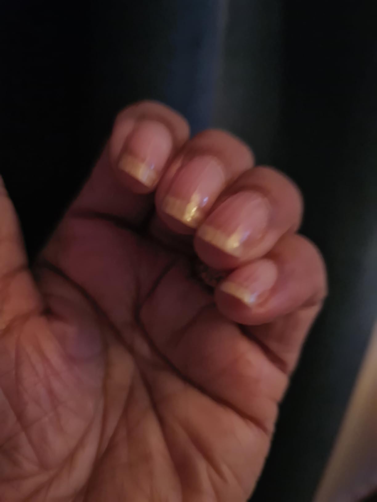 NailAid Biotin Ultimate Strength, .55 fl oz Amazon.co.uk Beauty