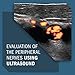Ultrasound Evaluation of Focal Neuropathies: Correlation with Electrodiagnosis