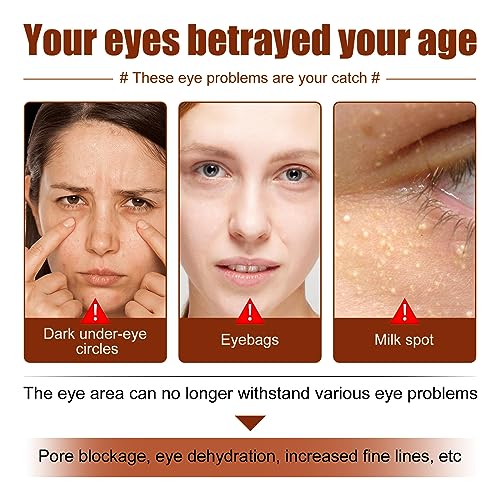 Milia Removal Eye Creams,Milia Spots Removal Eye Cream,Milia Remover,Firming Anti Wrinkle Whitening Eye Cream,Smooth Milia Eyes Cream,Milia Spot Care Cream,15g - Image 5