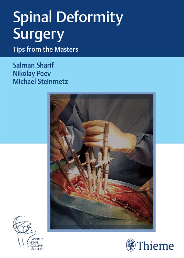Spinal Deformity Surgery: Tips from the Masters (English Edition)