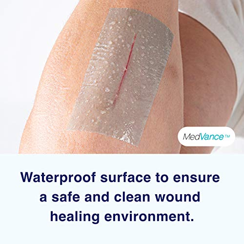 Medvance Soft Silicone Tape With Perforation For Easy Cut Size - 1" Width (3 Pack, 5 Yards) #TOP4