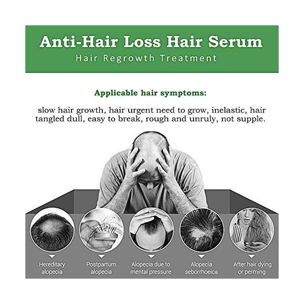 Ginger-Germinal-Oil-Ginger-Hair-Growth-Serum-Ginger-Essential-Oil-Stop-Hair-Loss-Hair-Thinning-Treatment-Hair-Growth-Oil-for-Women-Men-30ML-3-Pack Ginger Germinal Oil, Ginger Hair Growth Serum, Ginger Essential Oil Stop Hair Loss Hair, Thinning Treatment Hair Growth…