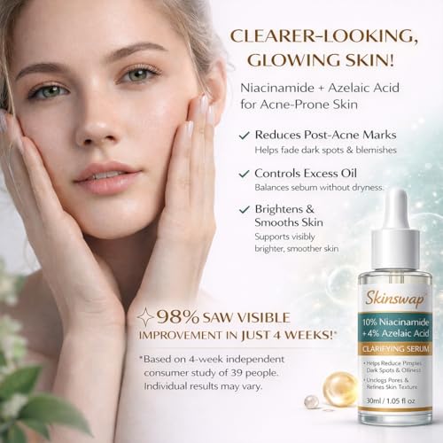Image of Active 14% Niacinamide Serum with Azelaic Acid | Clarifying Face Serum for Brightening & Oil Control | Helps Reduce Acne, Blemishes & Acne Marks | Smooth, Clear-Looking Skin | For Women & Men | 30 ml