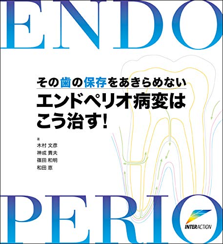 無料電子書籍 アプリ エンドペリオ病変はこう治す!―その歯の保存をあきらめない! バイ