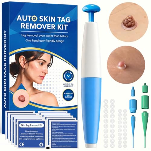 Stielwarzen Entferner Warzenentferner-Effektiv gegen Stielwarzen für Zuhause Skin Tag Remover Wirksam Sicher & Einfach ohne Chemie Ideal für Hals Achseln Körper Alle Körperteile