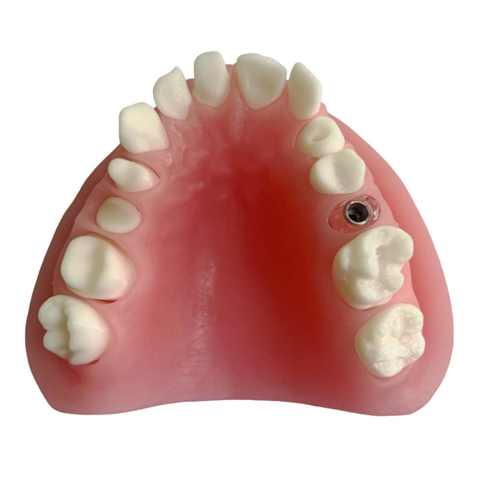 Modello espositivo per Protesi Dentarie Manichino Dentale Modello didattico per odontoiatria Orale Stampi per odontoiatria Orale,B