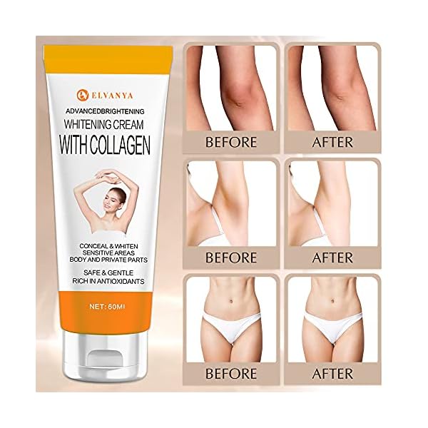 Dark-Spot-Corrector-Underarm-Cream-for-Armpit-Elbows-Knees-Neck-Private-Areas-Dark-Spot-Cream Dark Spot Corrector - Underarm Cream for Armpit, Elbows, Knees, Neck , Private Areas - Dark Spot Cream