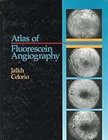 Atlas of Fluorescein Angiography 0721636411 Book Cover