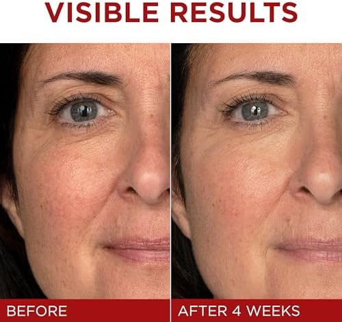 Revitalift Triple Power Anti-Aging Face Moisturizer,