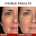 L'Oreal Paris Revitalift Triple Power Anti-Aging Face Moisturizer, Pro Retinol, Hyaluronic Acid & Vitamin C, Reduce Wrinkles 2.55 Oz - Image 4