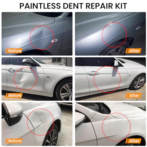 Image of Car Dent Puller Kit, Paintless Dent Removal Kit, Car Dent Repair Kit with Golden Lifter, Dent Remover Tool for Car Hail Damage DIY Repair