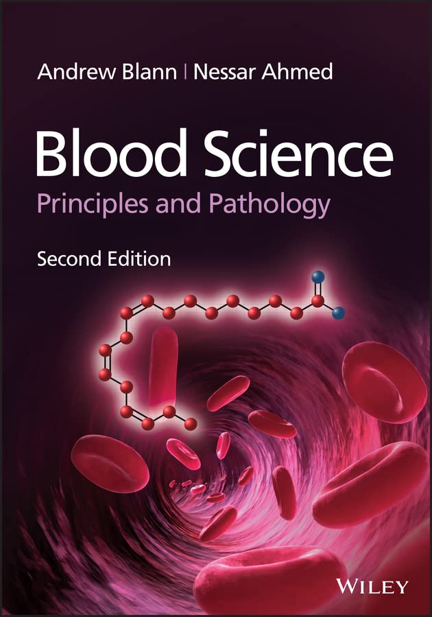 Blood Science: Principles and Pathology (English Edition)