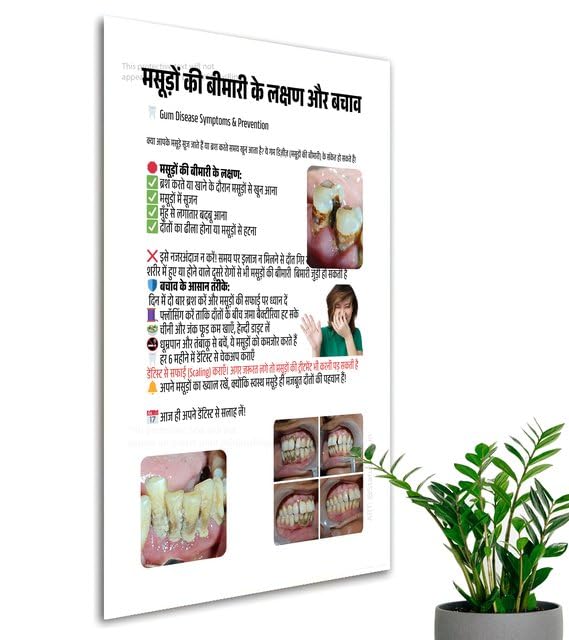 Perio Gum Problems Periodontist hindi Dental patient Education poster StatusRing Unframed-picture-23