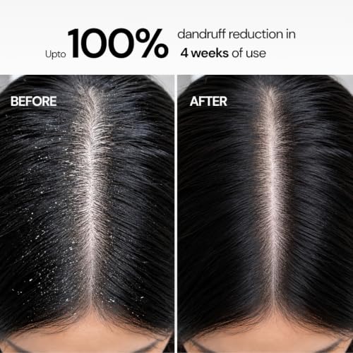 Image of Anti Dandruff Shampoo with 6.5% Balanced Active Blend | 2% Zinc Pyrithione, Piroctone Olamine, Tea Tree Oil, Salicylic Acid, Argan Oil & Neem | Dandruff Control, Itchy Scalp & Flake Removal Shampoo for Men, Women, Boys, Girls & Teens | Sulphate Free | 200ml | Clarity Labs