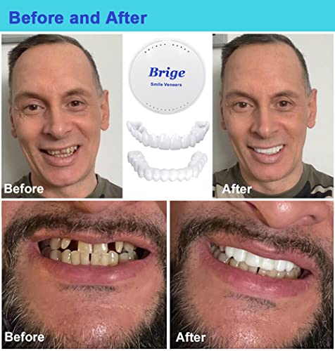 Denture Teeth Temporary Fake Teeth For Snap On Instant & Confidence Smile #TOP1