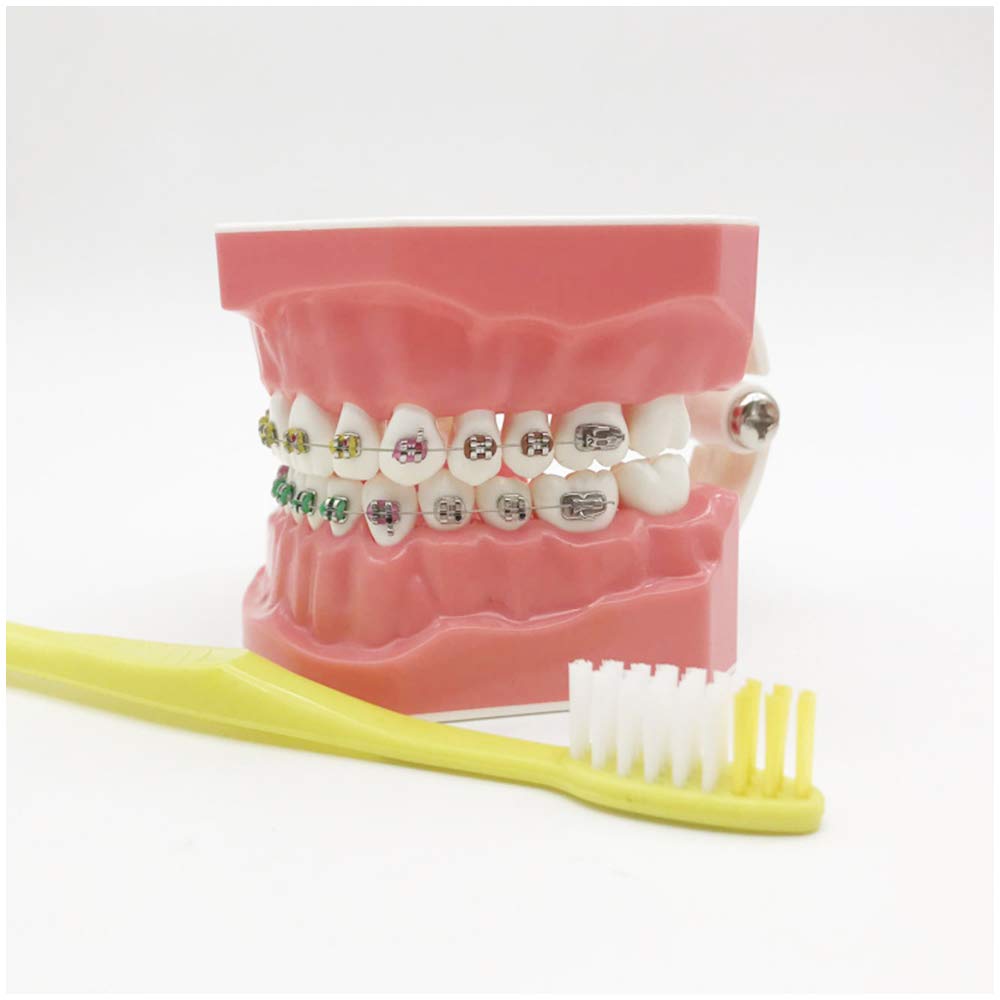 Modello Di Denti Per La Formazione - Modello Ortodontico - Modello Di Insegnamento Dei Denti Con Staffa In Metallo E Ceramica - Modello Di Formazione Correttiva Dei Denti Per L'insegnamento Dell'igien