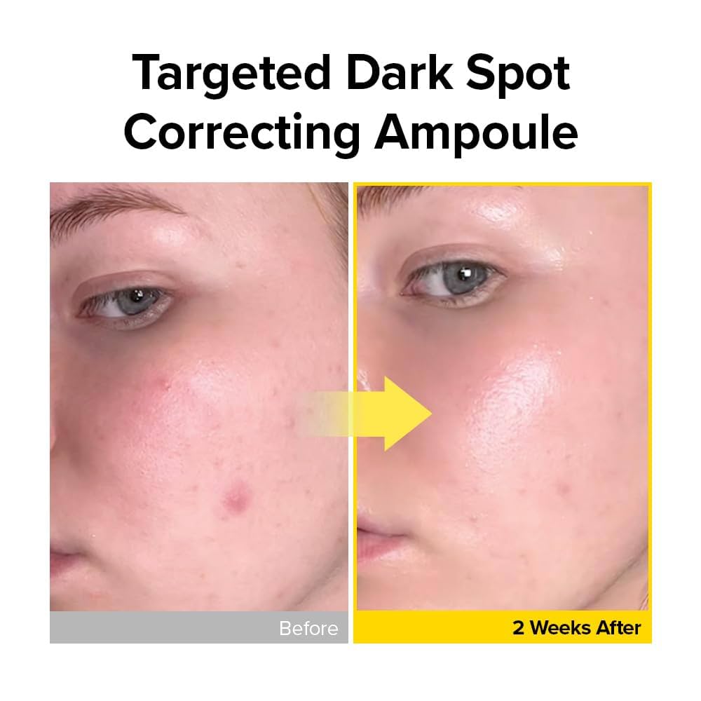 美容液 MIMU Amazon.com: MIMUMIMU Dark Spot Intensive Ampoule for