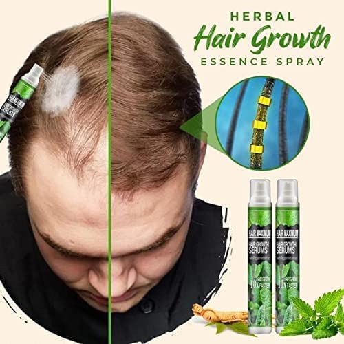 Hair-Growth Essence Spray, Anti Hair Loss Fast Growth Spray, Herbal Essence For Hair Growth, Hair Regrowth Treatment Spray For Stronger Hair Growth (1Pcs) #TOP5