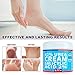 ASDToTio Urea Cream 42% - Premium Urea Foot Cream - With 2% Salicylic Acid, Tea Tree Oil, Shea Butter, Aloe Vera - For Feet, Hands, Heels, Elbows, Knees and More - 8 oz